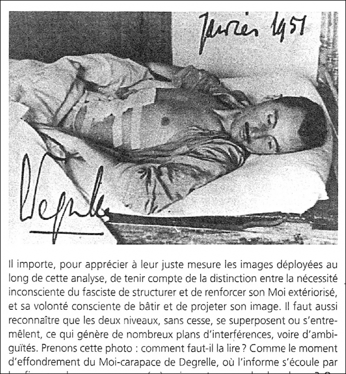 Littell LD opéré.jpeg